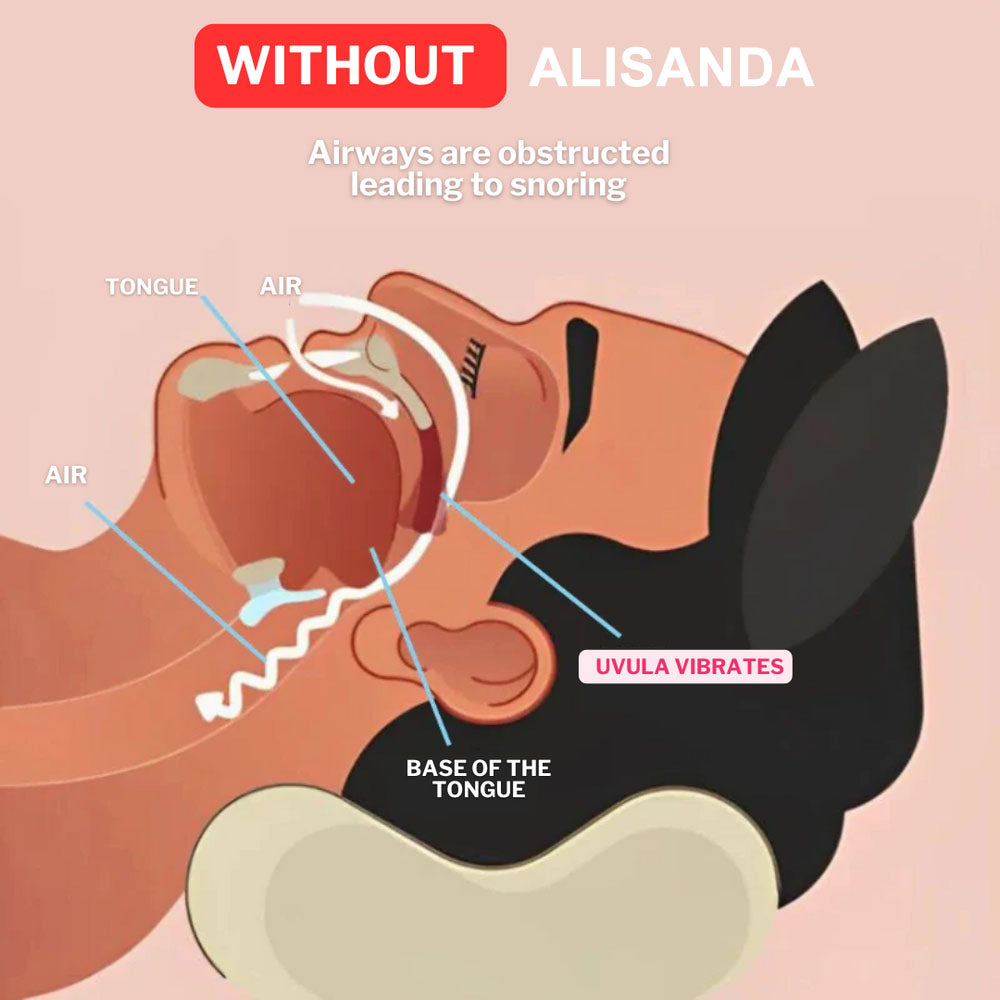 LAST DAY SALE 60% OFF ⏰ PerfectSleep Solution – Snore-Reducing & Teeth-Grinding Guard